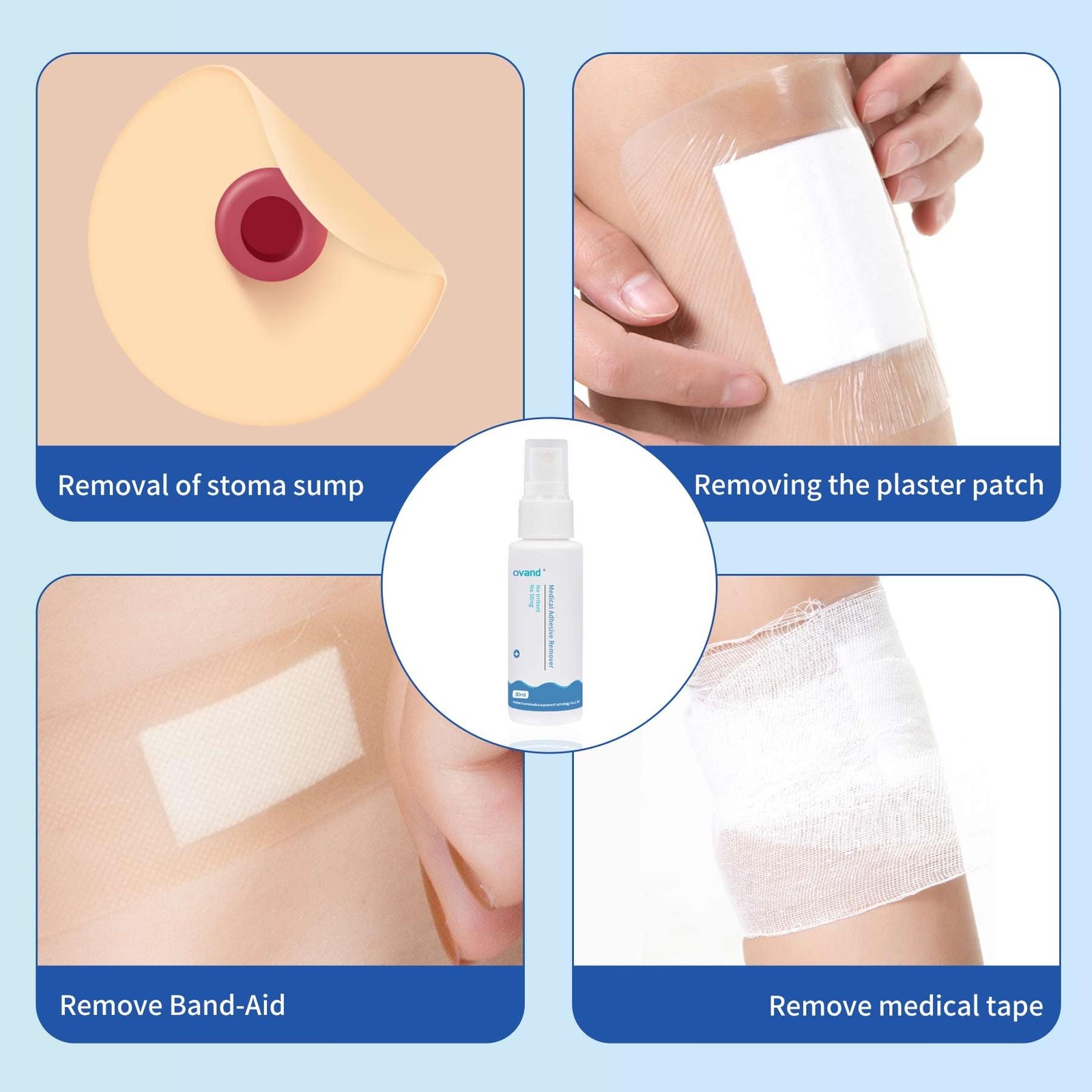 No-Sting Ostomy Adhesive Remover Spray 4 Pack 1oz Skin Mastectomy Tape Medical